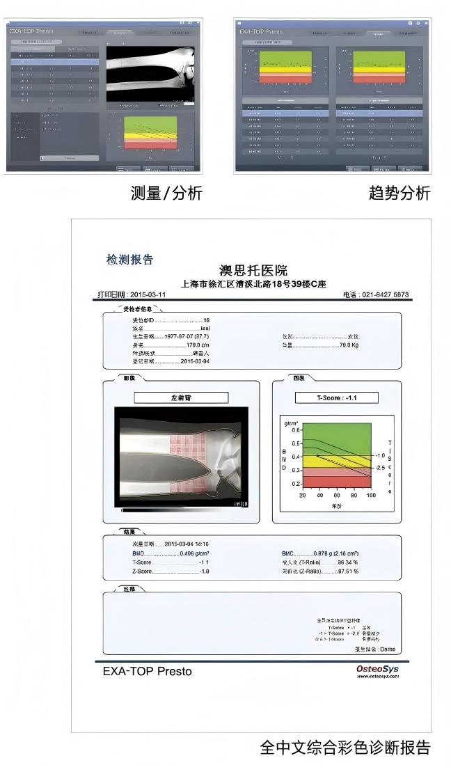 EXA-TOP Presto彩页2023-国产_02(1).jpg